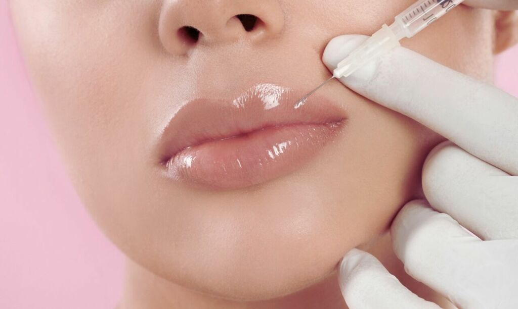 Lippen Aufspritzen Nürnberg – Für ein neues Selbstbewusstsein